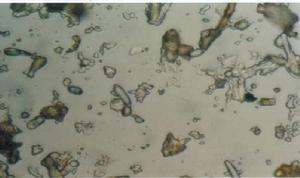 （图）炭疽菌孢子萌发过程